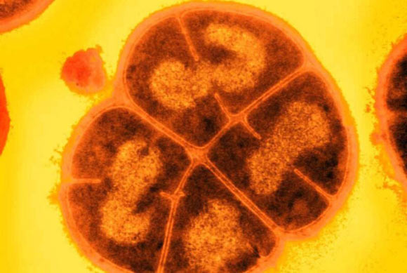 Déinocoque radiodurans. Crédit image : USU / Michael Daly.
